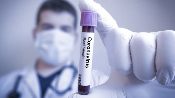 Вчерашний день: у 237 человек выявлен Covid-19, причем у ташкентцев - 195 положительных тестов Вчерашний день: у 237 человек выявлен Covid-19, причем у ташкентцев - 195 положительных тестов