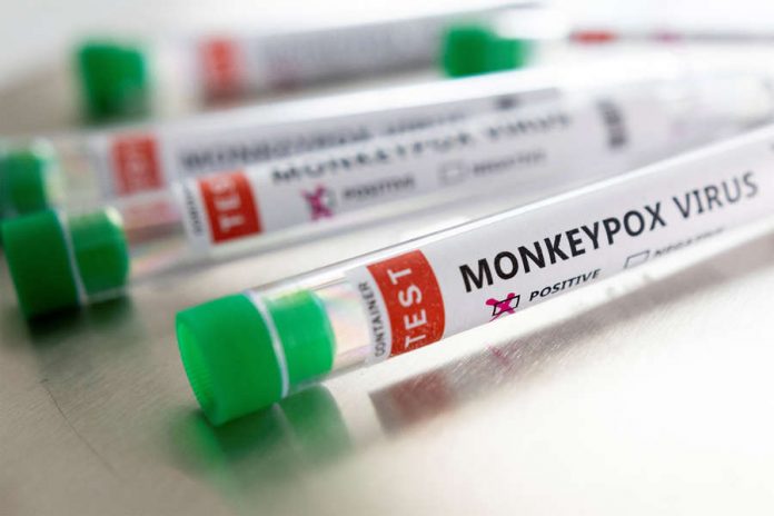 upload-2022-05-22T133954Z_364798899_RC2BCU91EQHZ_RTRMADP_3_HEALTH-MONKEYPOX-pic_32ratio_900x600-900x600-63877
